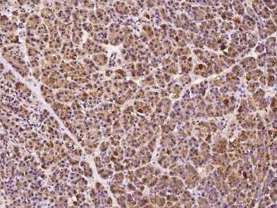 Immunohistochemistry-Paraffin: ABCD1 Antibody [NBP2-99337]