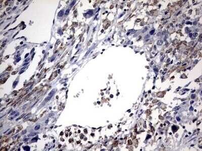 Immunohistochemistry: ABCD1 Antibody (OTI2C12) - Azide and BSA Free [NBP2-70150]