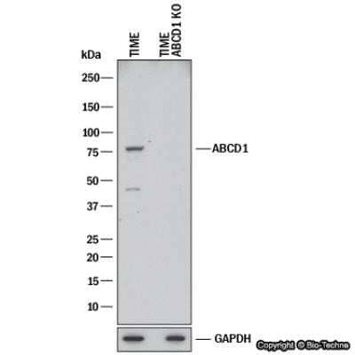 Knockout Validated: ABCD1 Antibody (OTI2C12) - Azide and BSA Free [NBP2-70150]