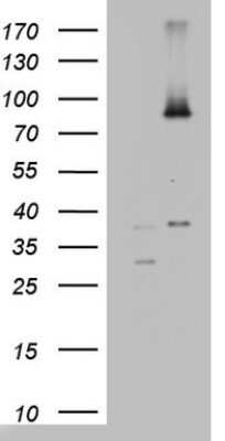 Western Blot: ABCD1 Antibody (OTI2C12)Azide and BSA Free [NBP2-70150]