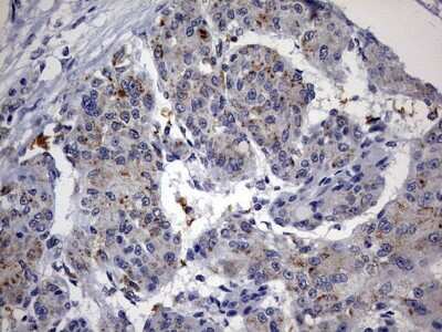 Immunohistochemistry: ABCD1 Antibody (OTI2C12) [NBP2-46476]