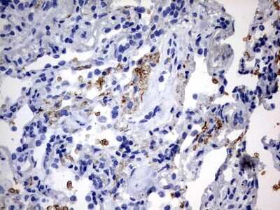 Immunohistochemistry: ABCD1 Antibody (OTI2C12) [NBP2-46476]