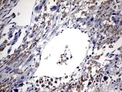 Immunohistochemistry: ABCD1 Antibody (OTI2C12) [NBP2-46476]
