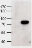 Western Blot: ABCD1 Antibody [NB100-96913]