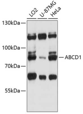 Western Blot: ABCD1 AntibodyAzide and BSA Free [NBP2-92604]