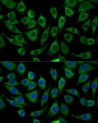 Immunocytochemistry/ Immunofluorescence: ABCD2 Antibody - Azide and BSA Free [NBP2-92633]