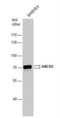 Western Blot: ABCD2 Antibody [NBP1-33435]