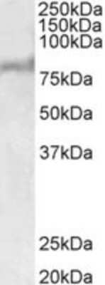 Western Blot: ABCD2 Antibody [NBP2-26123]