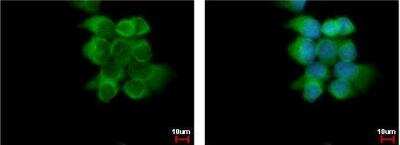 Immunocytochemistry/ Immunofluorescence: ABCD4 Antibody [NBP2-21601]