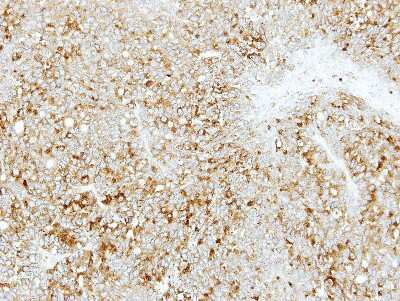 Immunohistochemistry-Paraffin: ABCD4 Antibody [NBP2-21601]