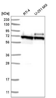 Western Blot: ABCE1 Antibody [NBP2-58061]