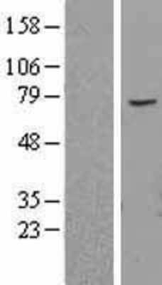 Western Blot: ABCE1 Overexpression Lysate [NBL1-07182]