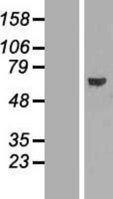 Western Blot: ABCE1 Overexpression Lysate [NBL1-07183]