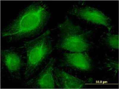 Immunocytochemistry/ Immunofluorescence: ABCF1 Antibody (1B4) [H00000023-M01]