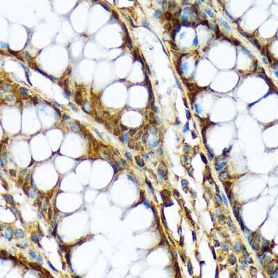 Immunohistochemistry-Paraffin: ABCF1 Antibody (4P9V8) [NBP3-15819]