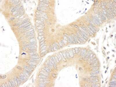 Immunohistochemistry: ABCF1 Antibody [NBP1-18888]
