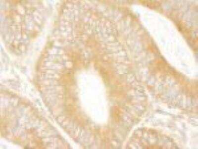 Immunohistochemistry-Paraffin: ABCF1 Antibody [NBP1-18889]