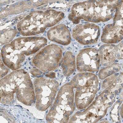 Immunohistochemistry-Paraffin: ABCF1 Antibody [NBP1-89314]