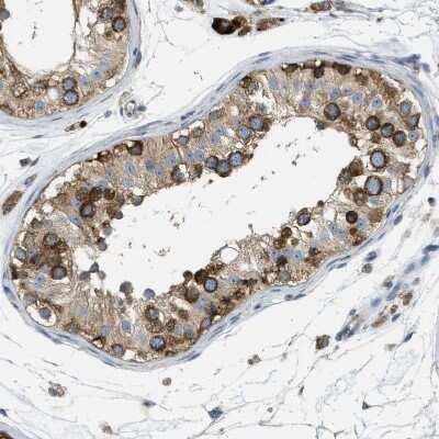 Immunohistochemistry-Paraffin: ABCF1 Antibody [NBP1-89314]