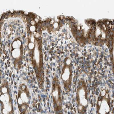 Immunohistochemistry-Paraffin: ABCF1 Antibody [NBP1-89314]