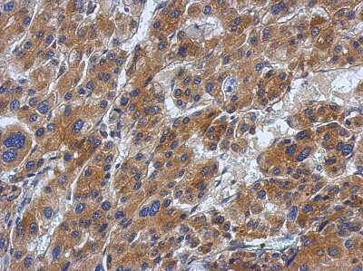 Immunohistochemistry-Paraffin: ABCF1 Antibody [NBP2-15226]