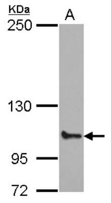 Western Blot: ABCF1 Antibody [NBP2-15226]