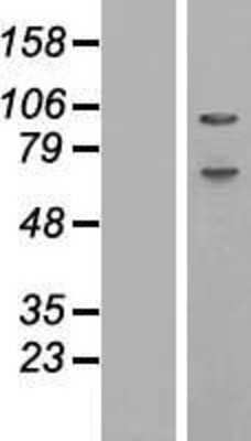 Western Blot: ABCF1 Overexpression Lysate [NBP2-08649]