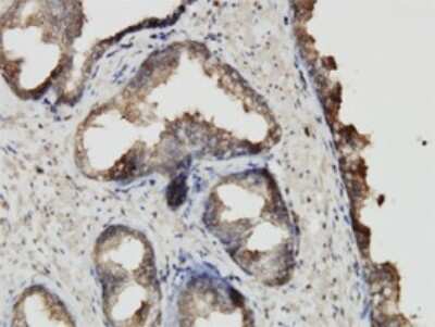Immunohistochemistry-Paraffin: ABCF2 Antibody (1D11) [H00010061-M01]