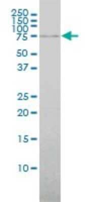 Western Blot: ABCF2 Antibody (1D11) [H00010061-M01]