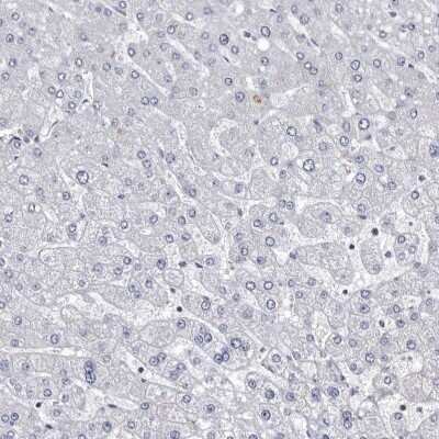 Immunohistochemistry-Paraffin: ABCF2 Antibody [NBP1-89316]