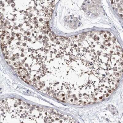 Immunohistochemistry-Paraffin: ABCF2 Antibody [NBP1-89316]