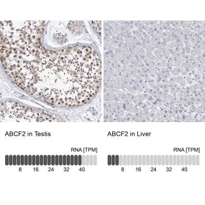 Immunohistochemistry-Paraffin: ABCF2 Antibody [NBP1-89316]