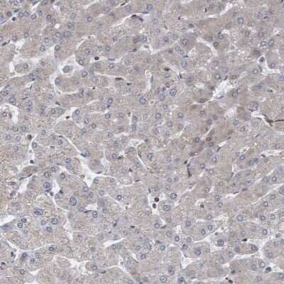 Immunohistochemistry-Paraffin: ABCF2 Antibody [NBP1-89317]