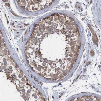 Immunohistochemistry-Paraffin: ABCF2 Antibody [NBP1-89317]