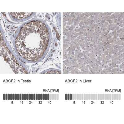 Immunohistochemistry-Paraffin: ABCF2 Antibody [NBP1-89317]