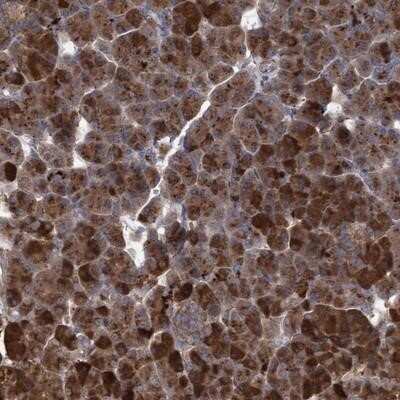 Immunohistochemistry-Paraffin: ABCF2 Antibody [NBP1-89318]