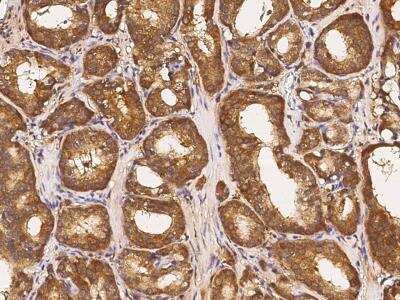 Immunohistochemistry-Paraffin: ABCF2 Antibody [NBP2-98976]