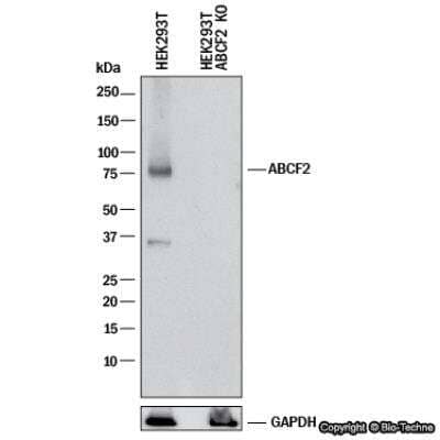 Knockdown Validated: ABCF2 Antibody [NB400-115]