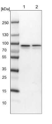Western Blot: ABCF2 Antibody [NBP1-89316]