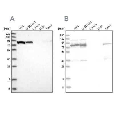 Western Blot: ABCF2 Antibody [NBP1-89316]