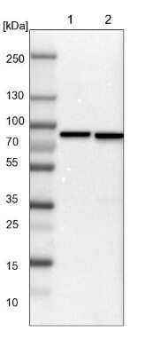 Western Blot: ABCF2 Antibody [NBP1-89317]