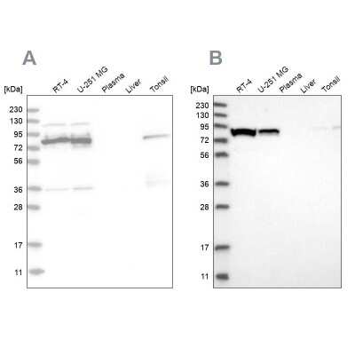 Western Blot: ABCF2 Antibody [NBP1-89317]