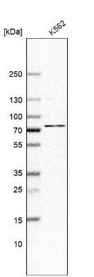 Western Blot: ABCF2 Antibody [NBP1-89318]