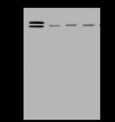 Western Blot: ABCF2 Antibody [NBP2-98977]