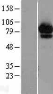 Western Blot: ABCF2 Overexpression Lysate [NBL1-07184]