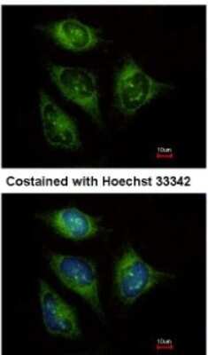 Immunocytochemistry/ Immunofluorescence: ABCF3 Antibody [NBP2-15227]