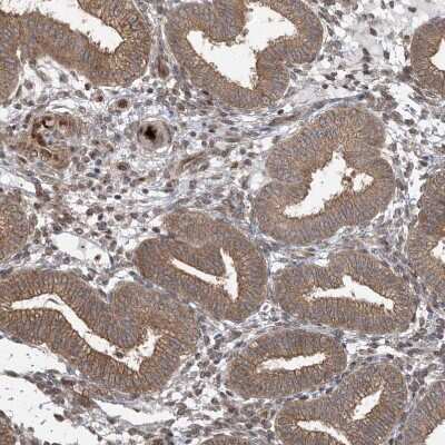 Immunohistochemistry-Paraffin: ABCF3 Antibody [NBP1-84781]