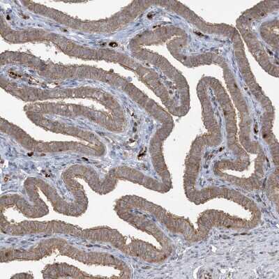 Immunohistochemistry-Paraffin: ABCF3 Antibody [NBP1-84781]