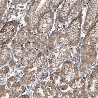 Immunohistochemistry-Paraffin: ABCF3 Antibody [NBP1-84781]