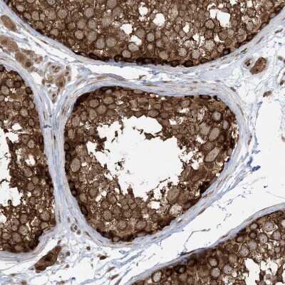 Immunohistochemistry-Paraffin: ABCF3 Antibody [NBP1-84781]